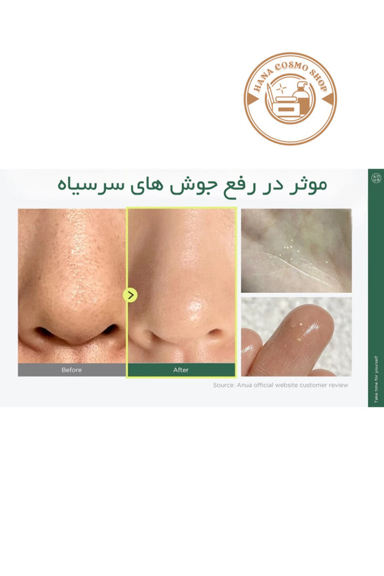 روغن پاک کننده آرایش آنوا اصل کره