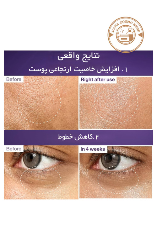 تاثیر دور چشم اسنس لیفتینگ شماره ۹ نامبوزین