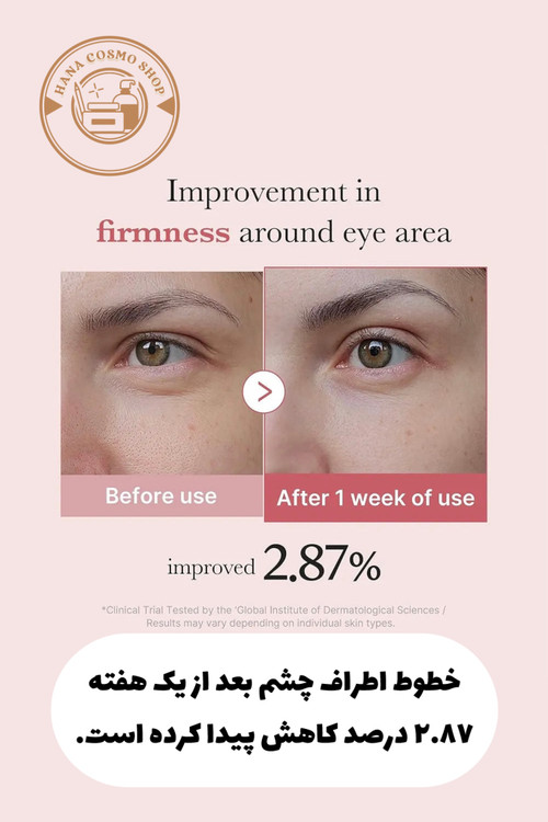 قبل و بعد کرم دور چشم پپتاید صورتی و PDRN مدی کیوب