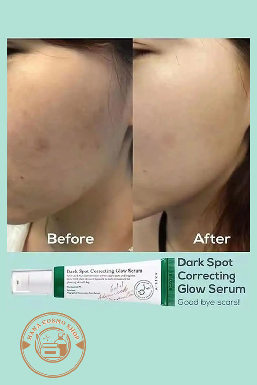 قبل وبعد ضدلک اکسیس وای