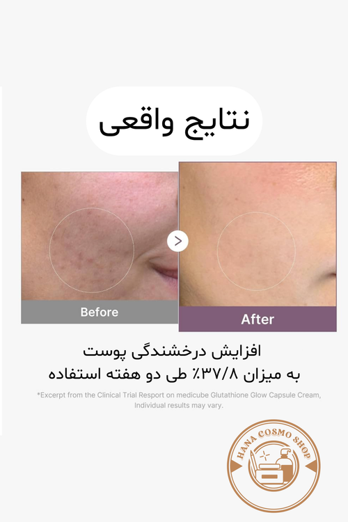 قبل و بعد کرم کپسولی گلوتاتیون مدیکیوب