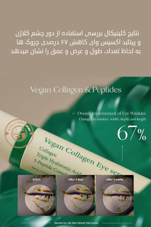 نتایج استفاده از کرم دور چشم اکسیس وای