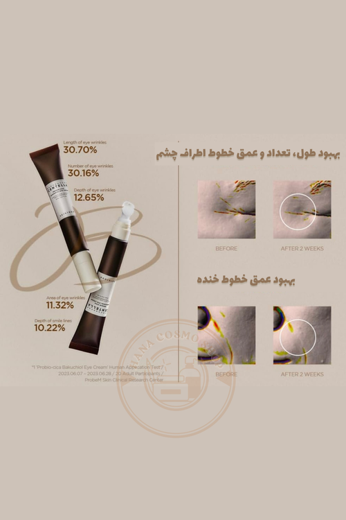 کرم دور چشم باکوچینول اسکین ۱۰۰۴