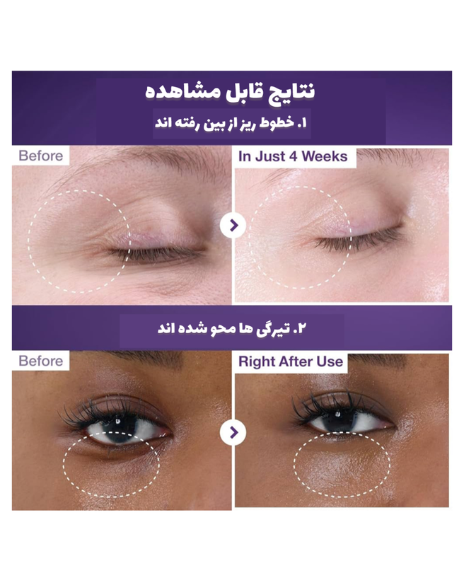 نتایج واقعی دور چشم نامبوزین