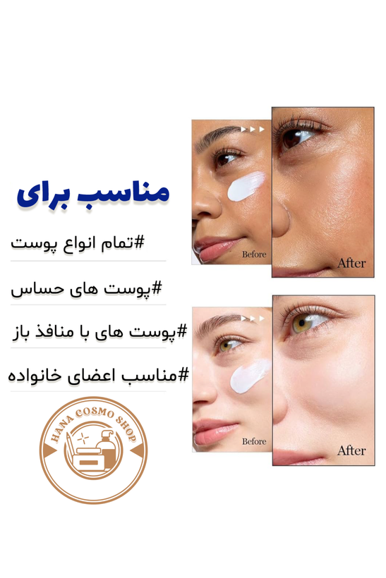 ویژگی های ضدآفتاب راندلب