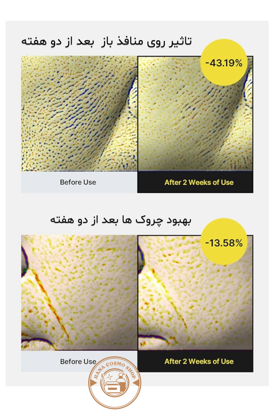 تاثیر روی خطوط صورت سرم جوانساز رتینول شات سلیمکس