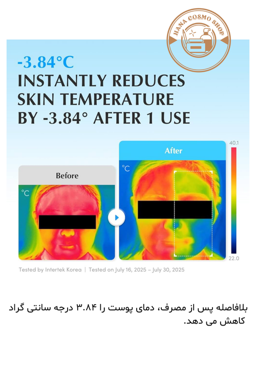 قبل و بعد سرم آبرسان هیالتوئین فلودینگ اکوال بری اصل